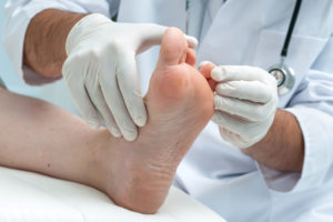 Екзема на ногах - причини, симптоми и лечение разних видов болезни на ногах