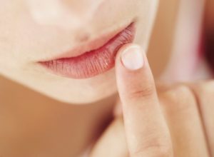 Папилломи на губах - види, причини появления, лечение и удаление