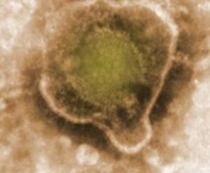 Фотография вируса под микроскопом